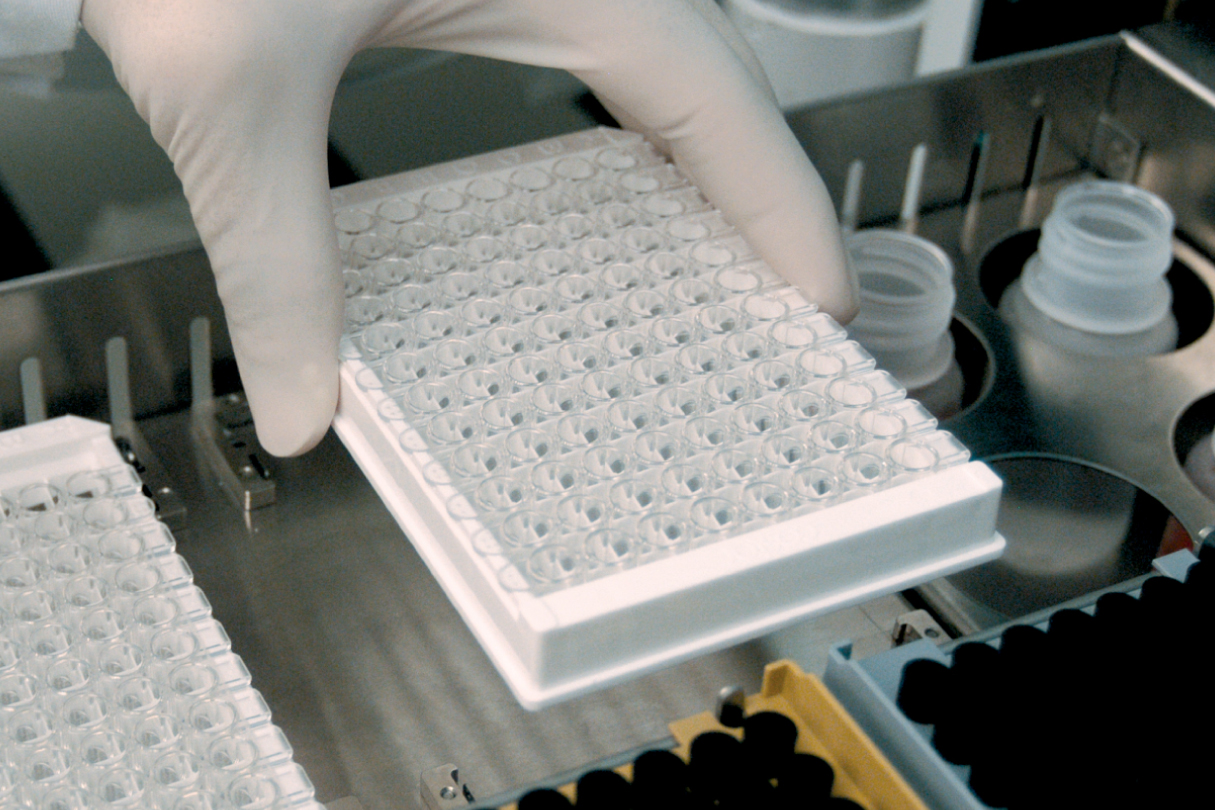 Antinuclear Antibody Testing How to Manage Loss of HEp2 IFA Expertise